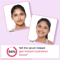 Thumbnail for Watermelon Burst Glow Face Serum with 2% Hyaluronic Acid | For glass skin | 28ml